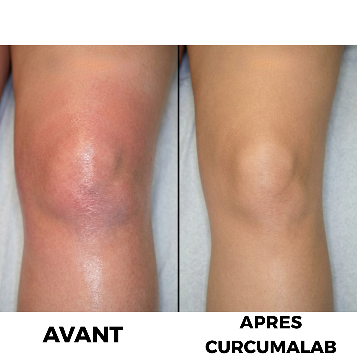 Kurkuma kapsulalari  bo‘g‘imlar va harakatchanlik uchun